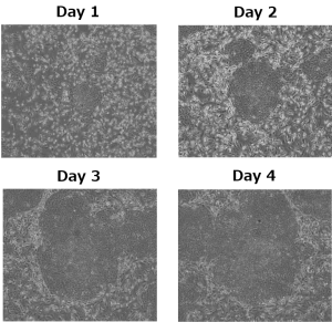 Embryoid Bodies (EB) of mouse iPS cells